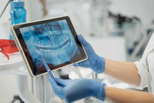 A dentist showing the results of a CBCT dental scan