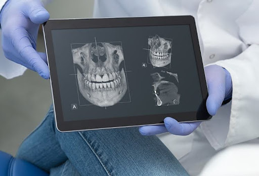 A dentist showing the results of a dental CBCT scan to his patient