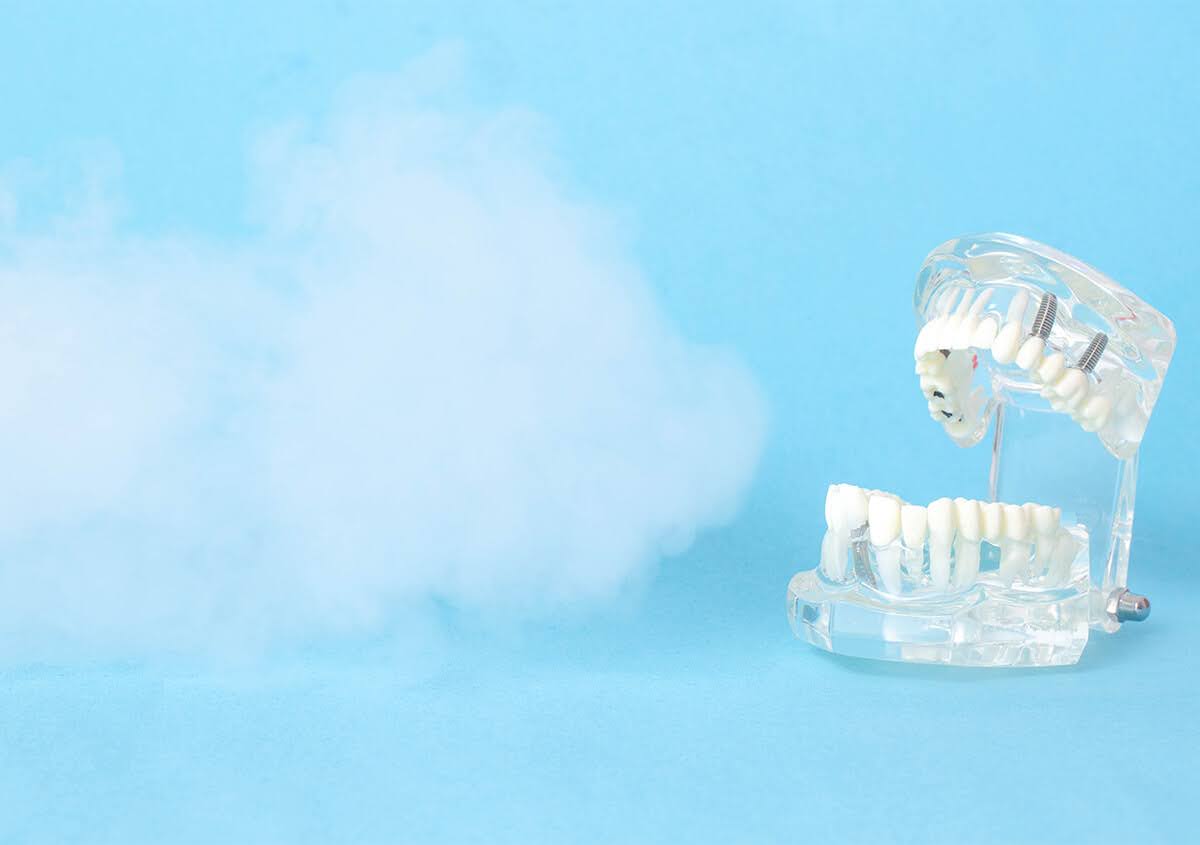 A tooth model showing how ozone treatment near you works