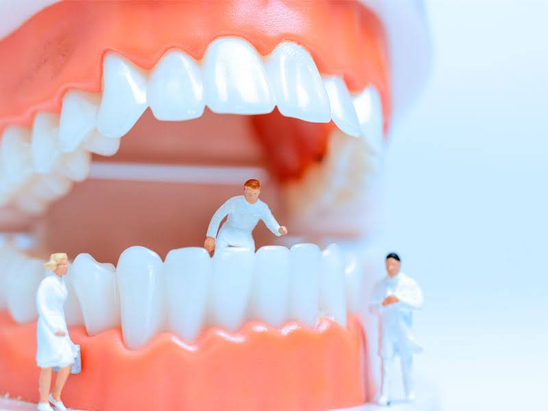  A model of teeth with tiny dentists surrounding it