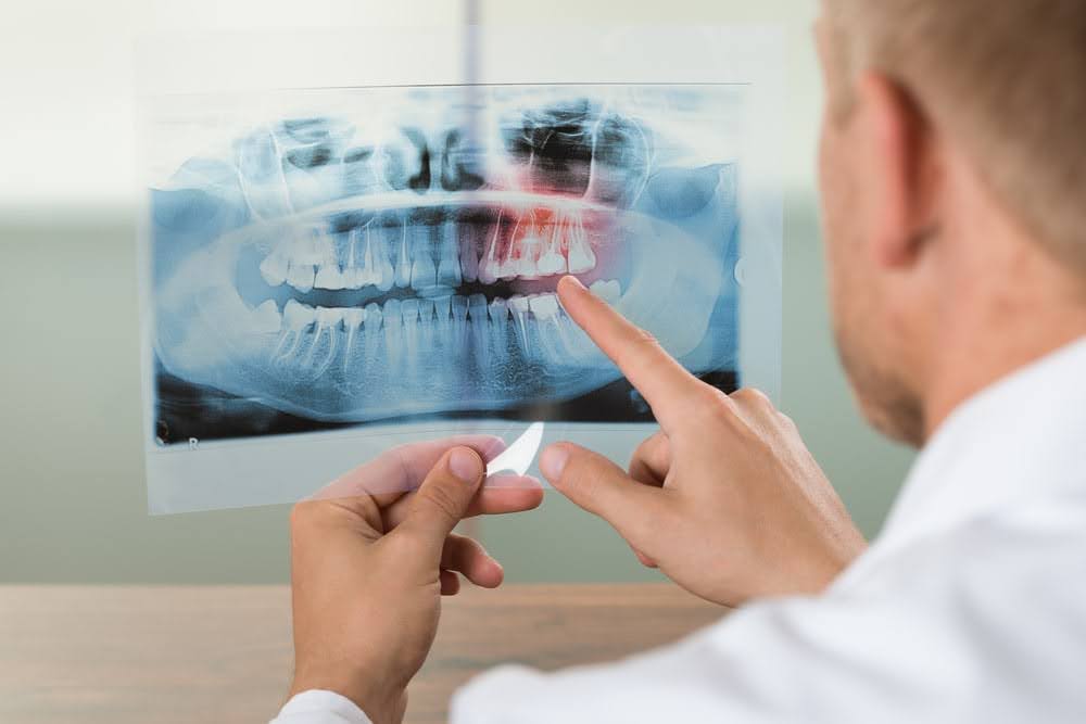  A dentist is examining the patient's teeth x-ray for ozone treatment near you for your teeth
