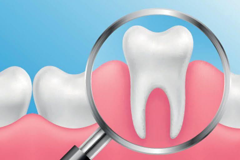  A visual representation of a complete tooth after having ozone treatment near you for teeth.