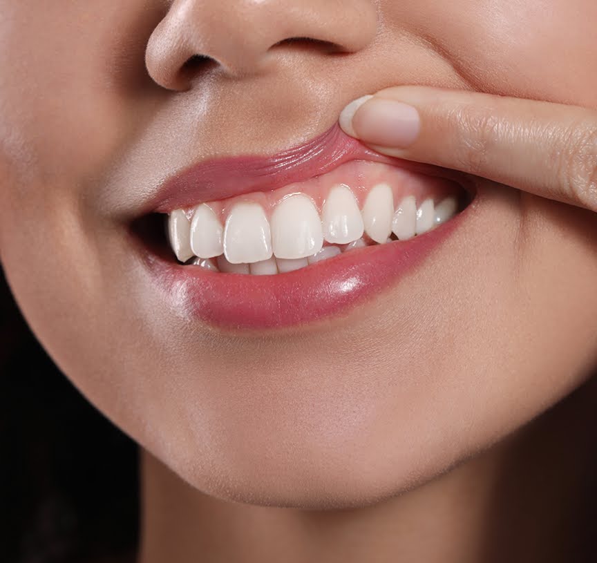   A young girl showing her healthy gums, highlighting the benefits of ozone therapy for gums