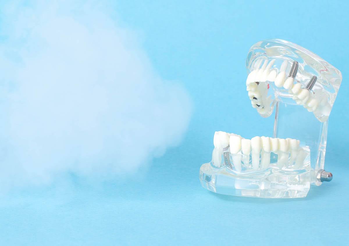  A close-up of a teeth model used to explain gum treatment with ozone
