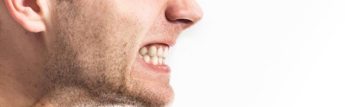  A Man With a TMJ Disorder, Grinding His Teeth