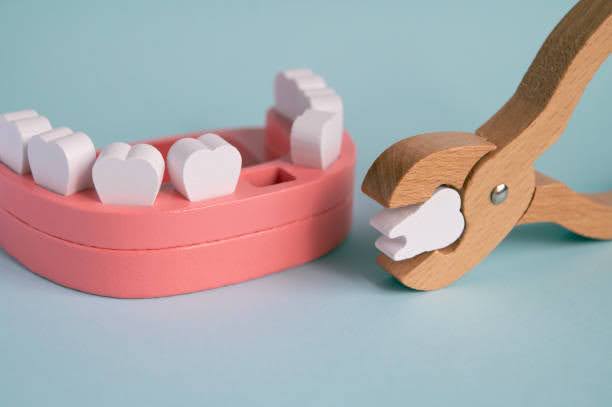  A wooden model of teeth with pliers showing how easy a gentle tooth extraction can be