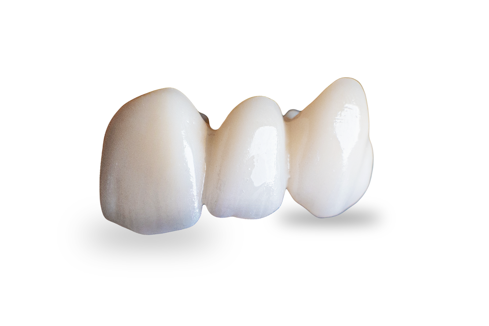   A Zirconia dental crown model on display