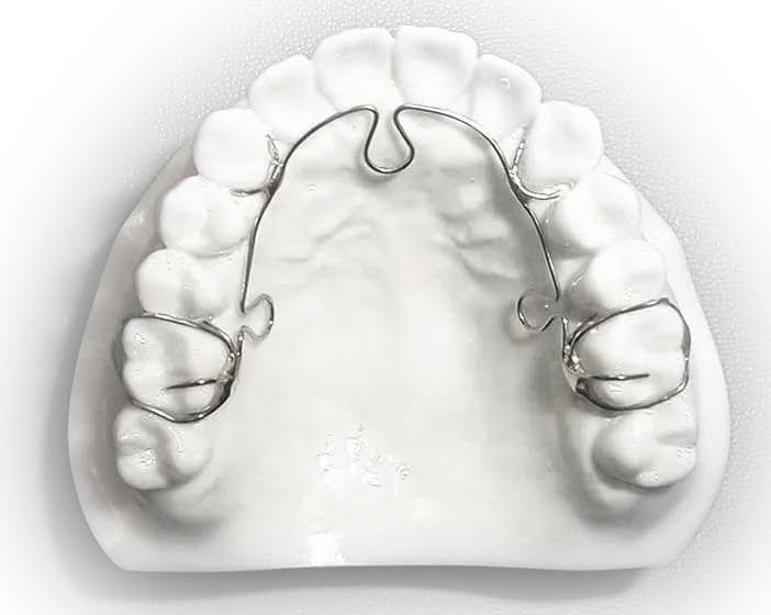  An advanced lightwire functional appliance on a model of teeth