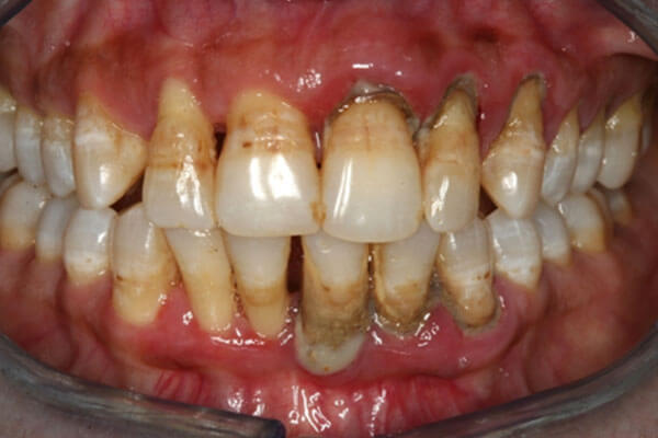 Smile Cafe NY Smile Cafe NY